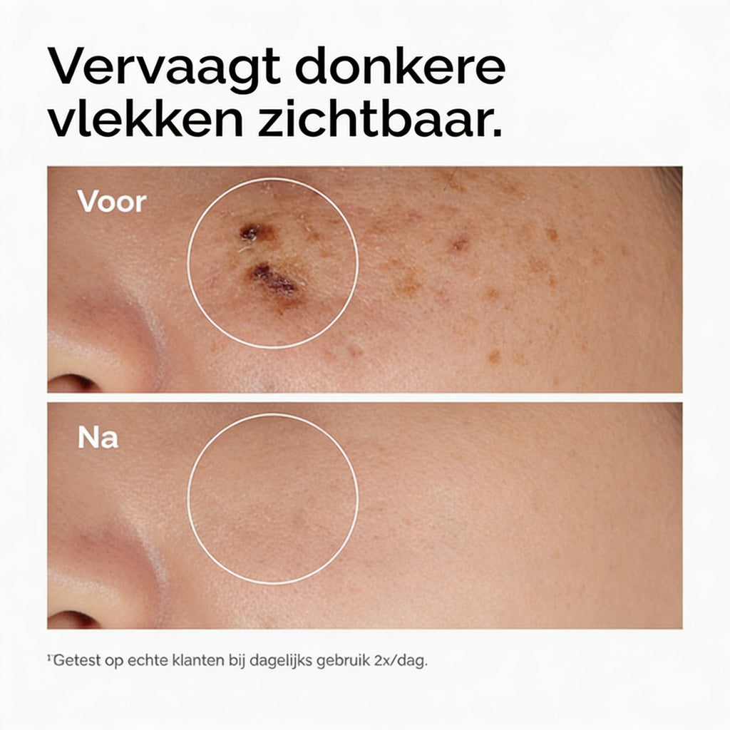 Niacinamide B3 Serum | 5% Daily Glow Formula