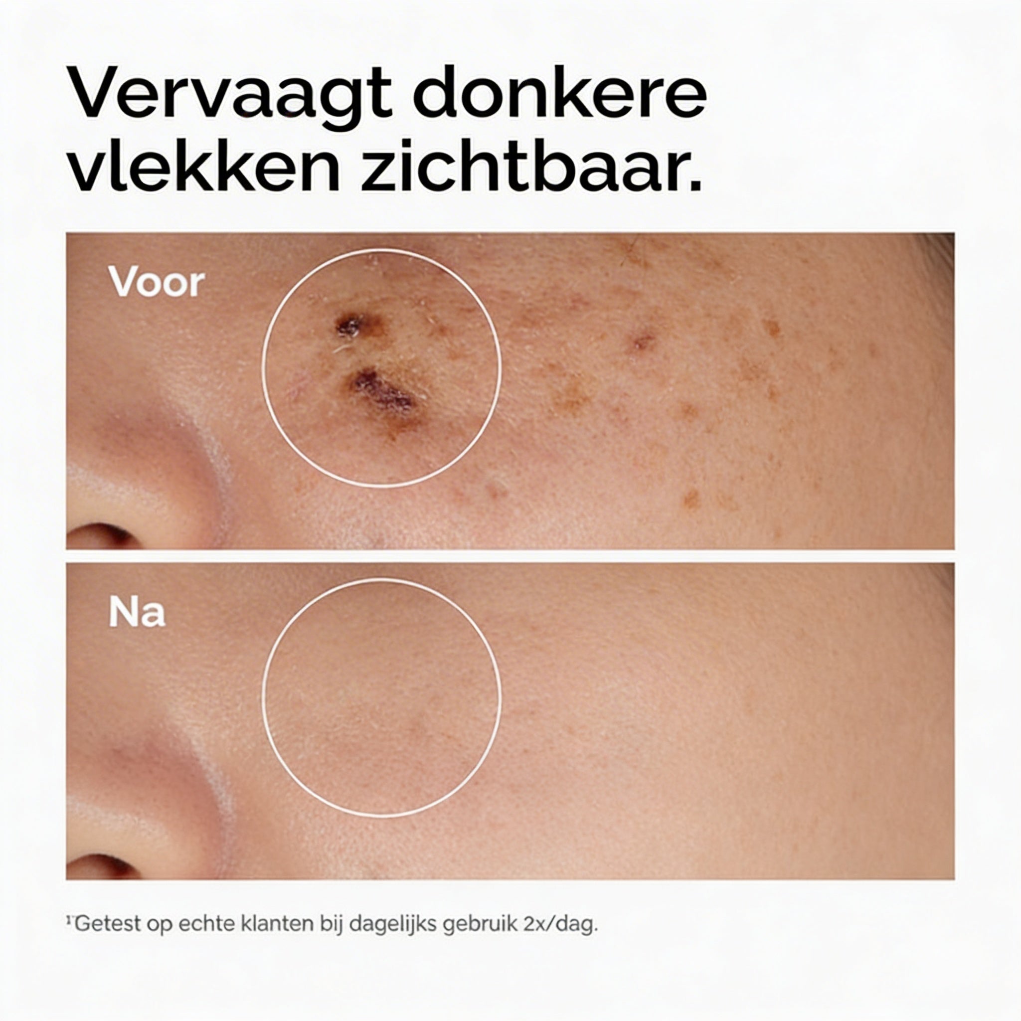 Niacinamide B3 Serum | 5% Daily Glow Formula
